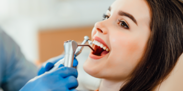 Професійна чистка зубів: чому вона потрібна і як проходить процедура